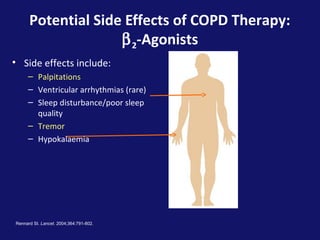 Potential Side Effects of COPD Therapy:
β2-Agonists
Rennard SI. Lancet. 2004;364:791-802.
• Side effects include:
– Palpitations
– Ventricular arrhythmias (rare)
– Sleep disturbance/poor sleep
quality
– Tremor
– Hypokalaemia
 
