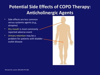 Potential Side Effects of COPD Therapy:
Anticholinergic Agents
• Side effects are less common
versus systemic agents (e.g.,
atropine)
• Dry mouth is most commonly
reported adverse event
• Urinary retention may be a
problem for patients with bladder
outlet disease
Rennard SI. Lancet. 2004;364:791-802.
 