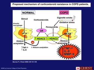 Proposed mechanism of corticosteroid resistance in COPD patients.
Barnes P J Chest 2006;129:151-155
©2006 by American College of Chest Physicians
 