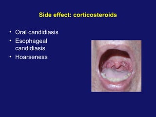 Side effect: corticosteroids
• Oral candidiasis
• Esophageal
candidiasis
• Hoarseness
 