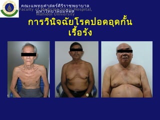 การวินิจฉัยโรคปอดอุดกั้น
เรื้อรัง
คณะแพทยศาสตร์ศิริราชพยาบาล
มหาวิทยาลัยมหิดลFaculty of Medicine Siriraj Hospital,
Mahidol University
 