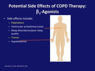 Potential Side Effects of COPD Therapy:
β2-Agonists
Rennard SI. Lancet. 2004;364:791-802.
• Side effects include:
– Palpitations
– Ventricular arrhythmias (rare)
– Sleep disturbance/poor sleep
quality
– Tremor
– Hypokalaemia
 