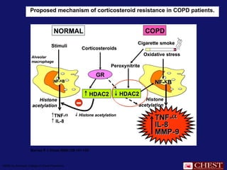 Proposed mechanism of corticosteroid resistance in COPD patients.
Barnes P J Chest 2006;129:151-155
©2006 by American College of Chest Physicians
 