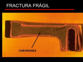 FRACTURA FRÁGIL
CHEVRONES
 