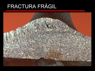 FRACTURA FRÁGIL
CHEVRONES
 