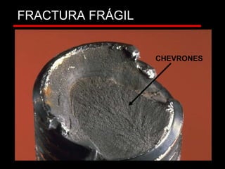 FRACTURA FRÁGIL
CHEVRONES
CHEVRONES
 