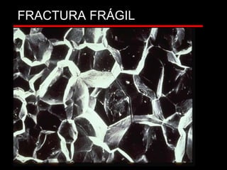 FRACTURA FRÁGIL
CHEVRONES
 