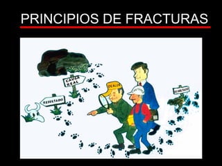 PRINCIPIOS DE FRACTURAS
 