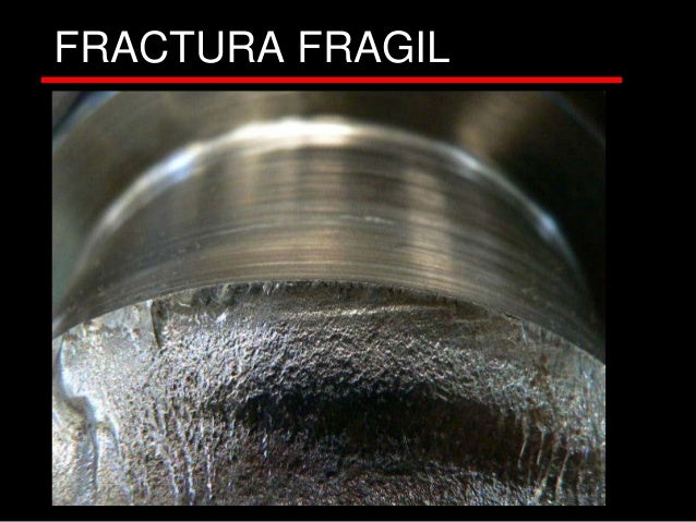 Estrías y marcas radiales en fractura frágil