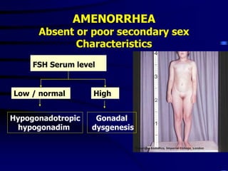 FSH Serum level
Low / normal High
Hypogonadotropic
hypogonadim
Gonadal
dysgenesis
AMENORRHEA
Absent or poor secondary sex
Characteristics
 