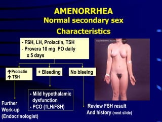 AMENORRHEA
Normal secondary sex
Characteristics
- FSH, LH, Prolactin, TSH
- Provera 10 mg PO daily
x 5 days
+ Bleeding No bleeing
Prolactin
 TSH
Further
Work-up
(Endocrinologist)
- Mild hypothalamic
dysfunction
- PCO (LH/FSH) Review FSH result
And history (next slide)
 