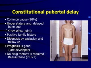 Constitutional pubertal delay
• Common cause (20%)
• Under stature and delayed
bone age
( X-ray Wrist joint)
• Positive family history
• Diagnosis by exclusion and
follow up
• Prognosis is good
(late developer)
• No drug therapy is required –
Reassurance (? HRT)
 