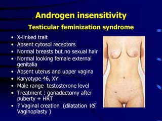 Androgen insensitivity
Testicular feminization syndrome
• X-linked trait
• Absent cytosol receptors
• Normal breasts but no sexual hair
• Normal looking female external
genitalia
• Absent uterus and upper vagina
• Karyotype 46, XY
• Male range testosterone level
• Treatment : gonadectomy after
puberty + HRT
• ? Vaginal creation (dilatation VS
Vaginoplasty )
 