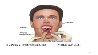 Fig :2 Picture of throat swab sample site (Windfuhr et al., 2006)
10
 