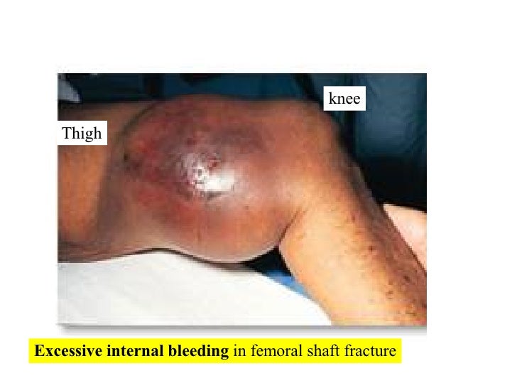 07 Appendicular Skeleton Pelvic Girdle And Lower Limbs