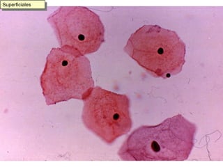 Células endocervicales 