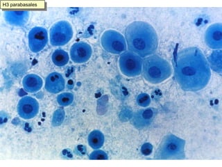 Células endometriales