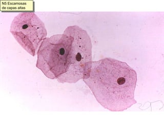 Leucocitos polinucleares neutrófilos 