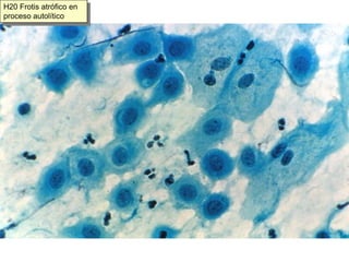 Células escamosas de exocérvix y vagina
