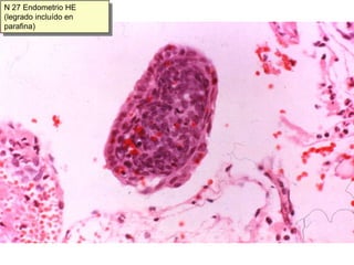 N3 Intermedias y superficiales