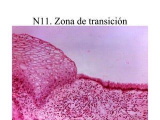 N 27 Endometrio HE (legrado incluído en parafina)