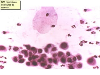 N11. Zona de transición