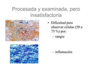 Insatisfactorio para la EvaluaciónO más del 75 % con dificultad para la observación (sangre, inflamación, desecación o capa gruesa)Ausencia de datos clínicosOtros: portaobjetos roto,...Menos del 10% de la superficie ocupado por células escamosas