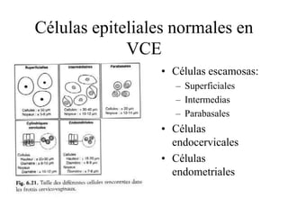 Células Normales en VCECélulas escamosas (parabasales, intermedias y superficiales).