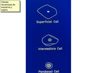 Bacilo de Döderlein