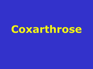 Coxarthrose
 