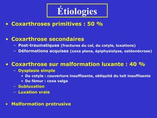 • Coxarthroses primitives : 50 %
• Coxarthrose secondaires
– Post-traumatiques (fractures du col, du cotyle, luxations)
– Déformations acquises (coxa plana, épiphysiolyse, ostéonécrose)
• Coxarthrose sur malformation luxante : 40 %
– Dysplasie simple
• Du cotyle : couverture insuffisante, obliquité du toit insuffisante
• Du fémur : coxa valga
– Subluxation
– Luxation vraie
• Malformation protrusive
Étiologies
 