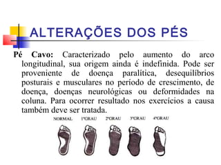 ALTERAÇÕES DOS PÉS
Pé Cavo: Caracterizado pelo aumento do arco
  longitudinal, sua origem ainda é indefinida. Pode ser
  proveniente de doença paralítica, desequilíbrios
  posturais e musculares no período de crescimento, de
  doença, doenças neurológicas ou deformidades na
  coluna. Para ocorrer resultado nos exercícios a causa
  também deve ser tratada.
 