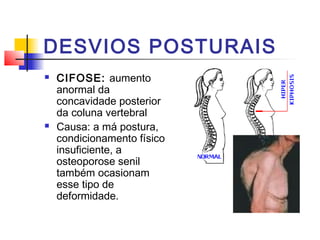 DESVIOS POSTURAIS
   CIFOSE: aumento
    anormal da
    concavidade posterior
    da coluna vertebral
   Causa: a má postura,
    condicionamento físico
    insuficiente, a
    osteoporose senil
    também ocasionam
    esse tipo de
    deformidade.
 