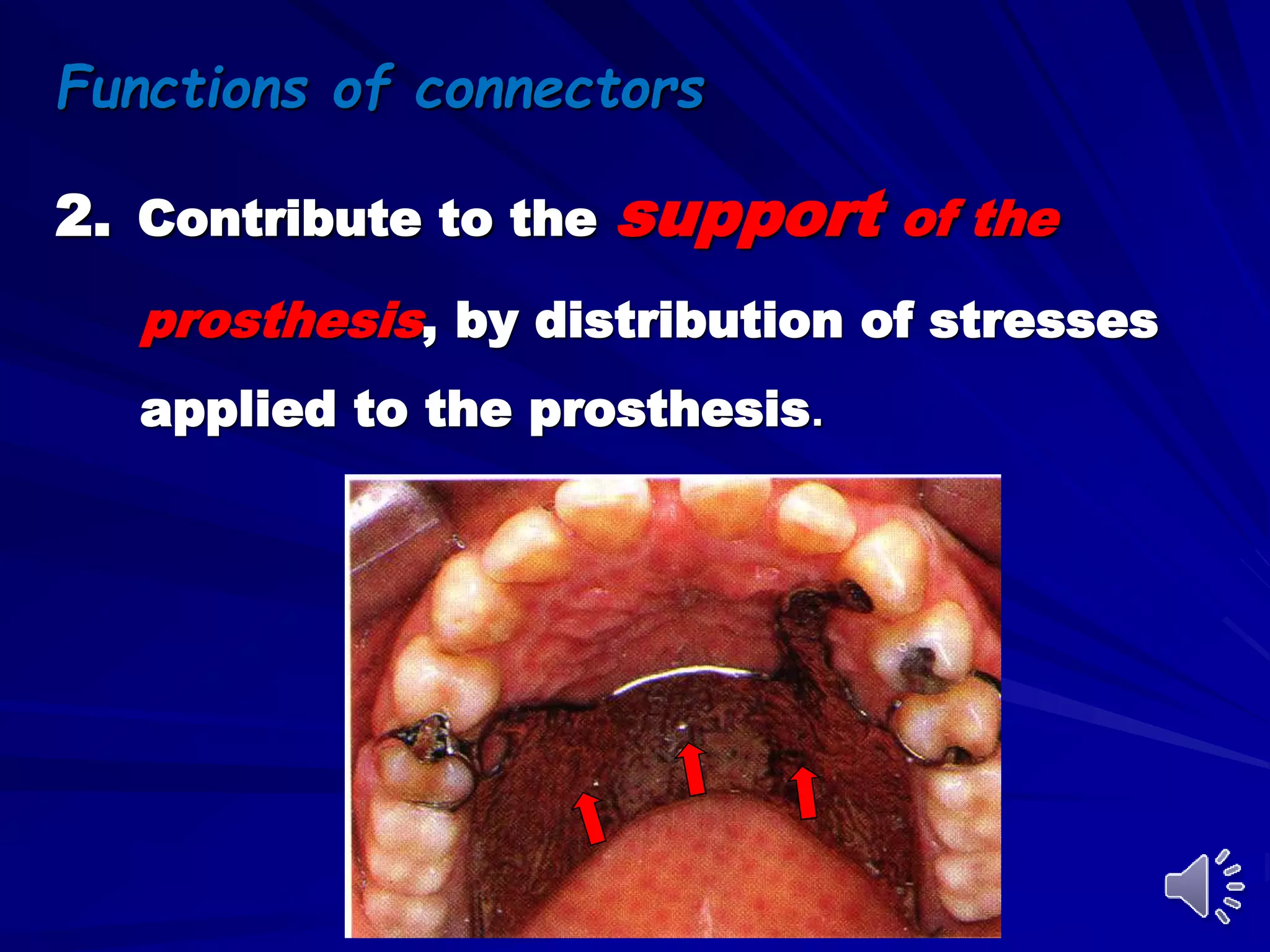2. Contribute to the support of the
prosthesis, by distribution of stresses
applied to the prosthesis.
Functions of connectors
 