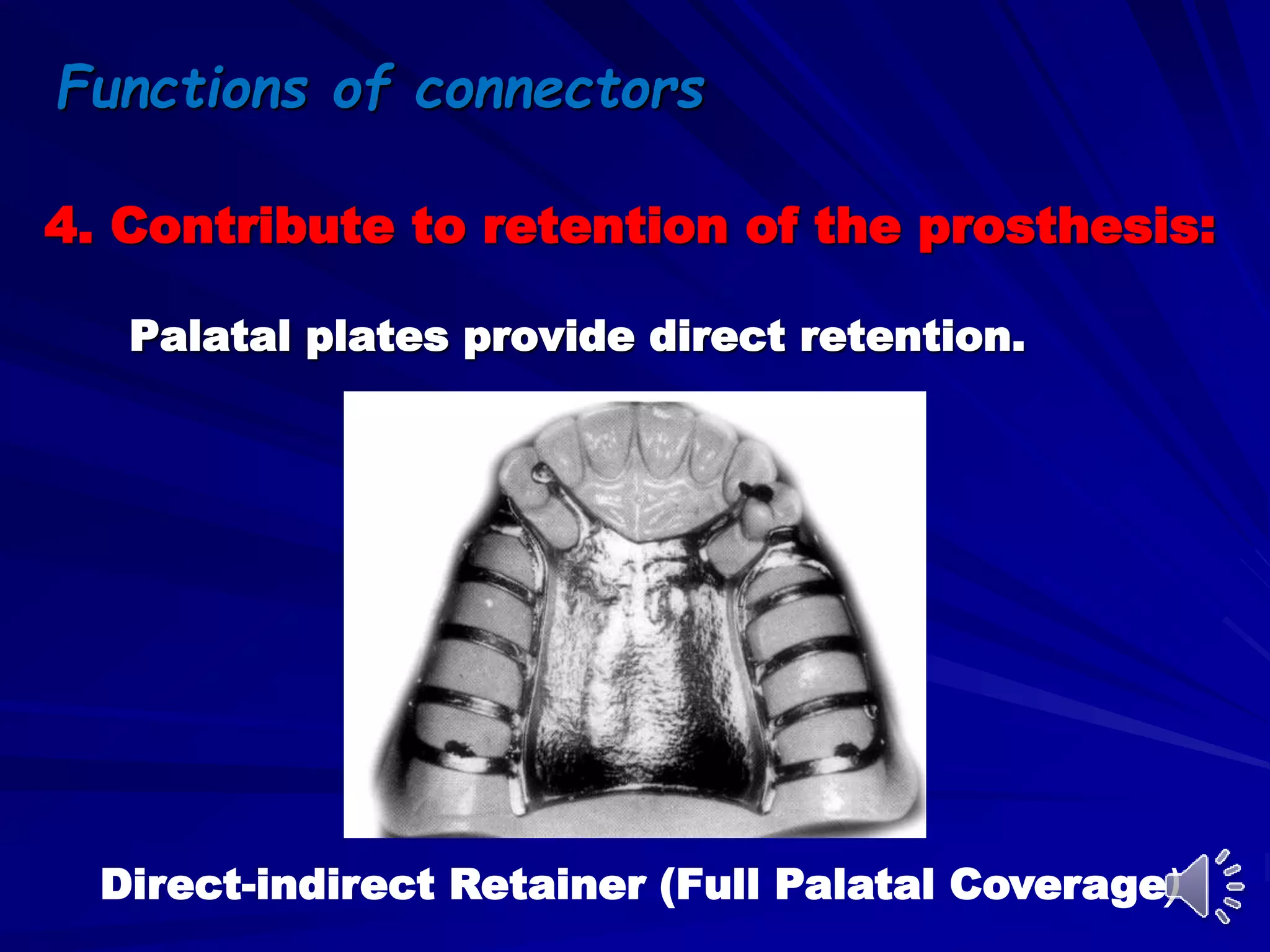 4. Contribute to retention of the prosthesis:
Palatal plates provide direct retention.
Direct-indirect Retainer (Full Palatal Coverage)
Functions of connectors
 