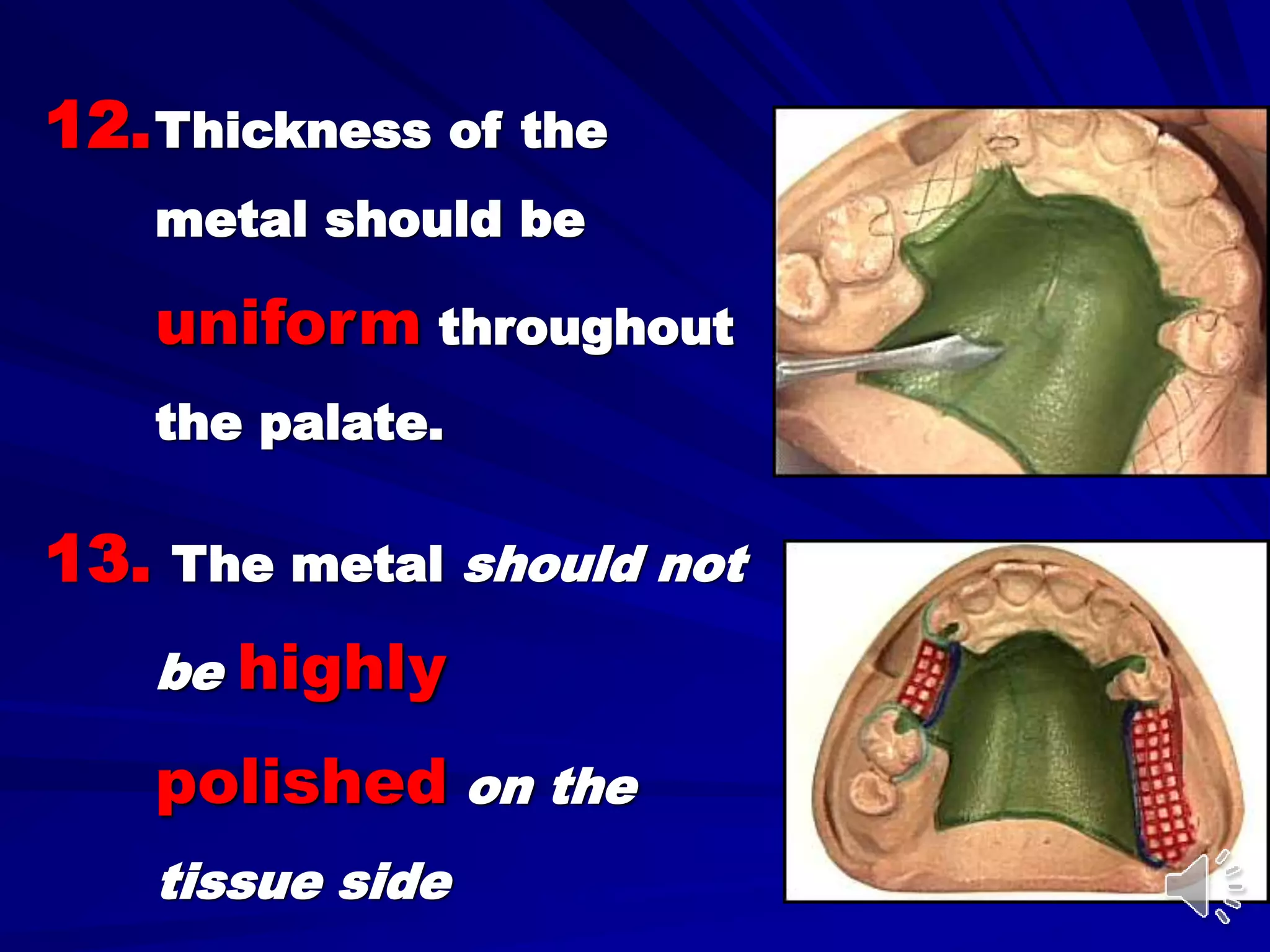 12.Thickness of the
metal should be
uniform throughout
the palate.
13. The metal should not
be highly
polished on the
tissue side
 
