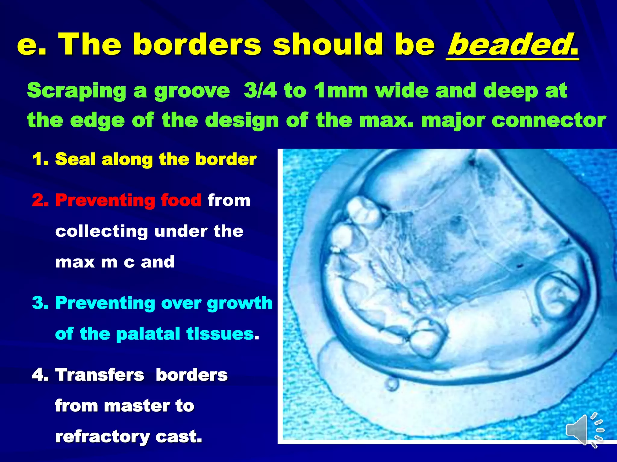 e. The borders should be beaded.
1. Seal along the border
2. Preventing food from
collecting under the
max m c and
3. Preventing over growth
of the palatal tissues.
4. Transfers borders
from master to
refractory cast.
Scraping a groove 3/4 to 1mm wide and deep at
the edge of the design of the max. major connector
 