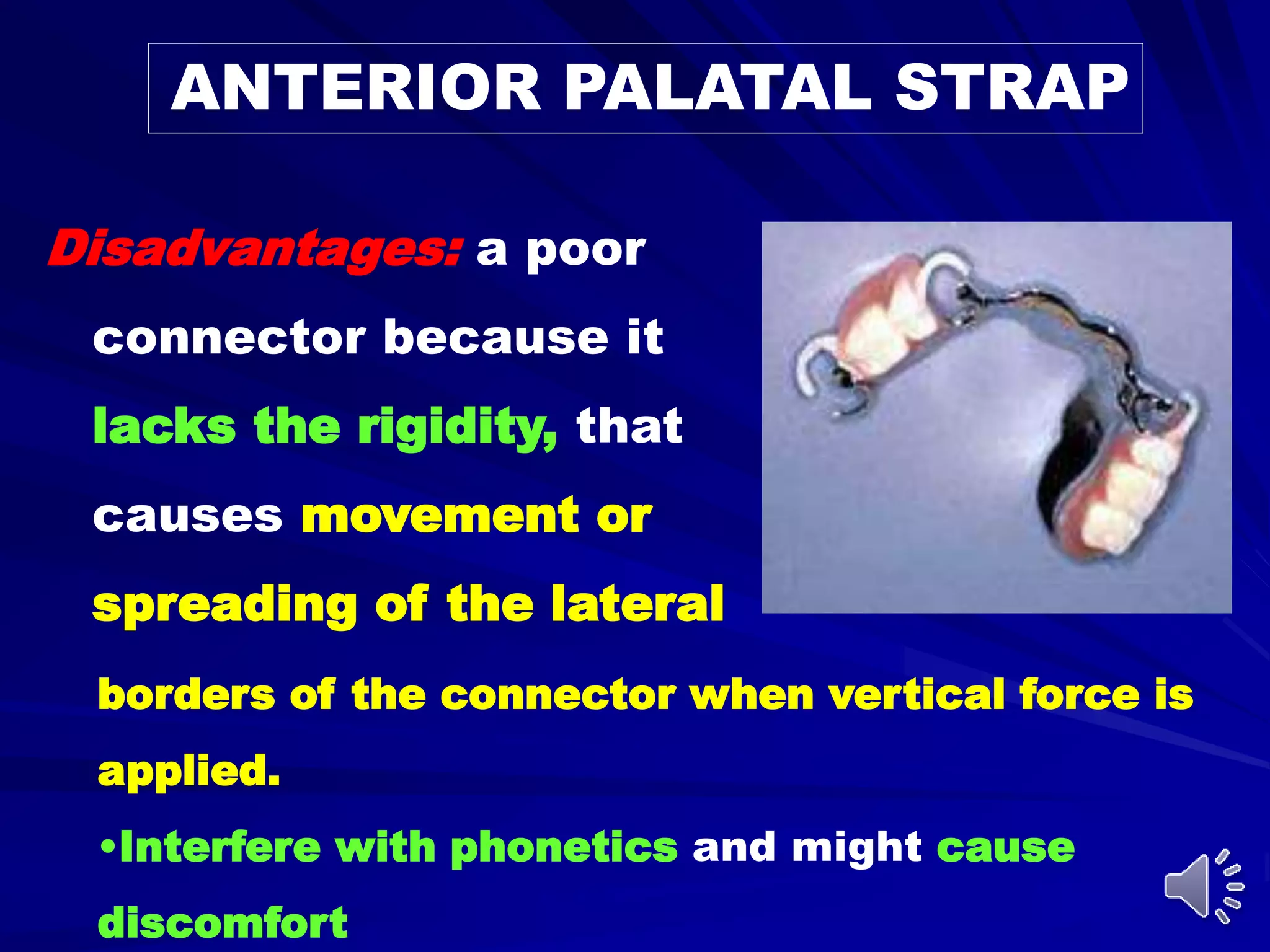 ANTERIOR PALATAL STRAP
Disadvantages: a poor
connector because it
lacks the rigidity, that
causes movement or
spreading of the lateral
borders of the connector when vertical force is
applied.
•Interfere with phonetics and might cause
discomfort
 