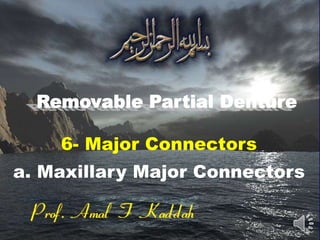 6- Major Connectors
a. Maxillary Major Connectors
 