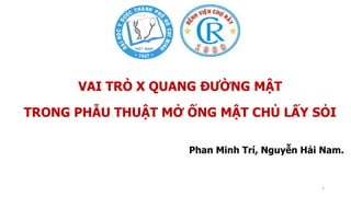 Phan Minh Trí, Nguyễn Hải Nam.
VAI TRÒ X QUANG ĐƯỜNG MẬT
TRONG PHẪU THUẬT MỞ ỐNG MẬT CHỦ LẤY SỎI
1
 