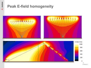 07/09/2017
13
Peak E-field homogeneity
 