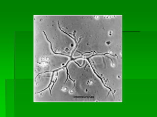 Interneuronas
 