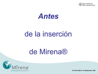 Antes de la inserción de Mirena ® 