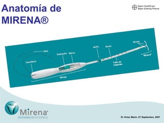 Anatomía de MIRENA ®  