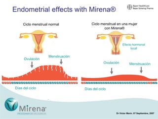 Endometrial effects with Mirena ® Days of cycle Ovulation Ovulation Menstruation Menstruation Days of cycle Ciclo menstrual normal Ciclo menstrual en una mujer con Mirena ® Ovulación Menstruación Ovulación Menstruación Días del ciclo Días del ciclo Efecto hormonal local 