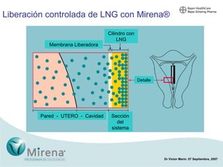 Liberación controlada de LNG con Mirena ® Cilindro con LNG Membrana Liberadora Pared  -  UTERO  -  Cavidad Sección del sistema Detalle 