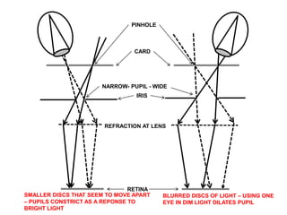 PINHOLE 
CARD 
NARROW- PUPIL - WIDE 
IRIS 
REFRACTION AT LENS 
BLURRED DISCS OF LIGHT – USING ONE 
EYE IN DIM LIGHT DILATES PUPIL 
RETINA 
SMALLER DISCS THAT SEEM TO MOVE APART 
– PUPILS CONSTRICT AS A REPONSE TO 
BRIGHT LIGHT 
