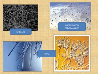 MICELIO CON
ESPORANGIOS
MICELIO

HIFAS

 
