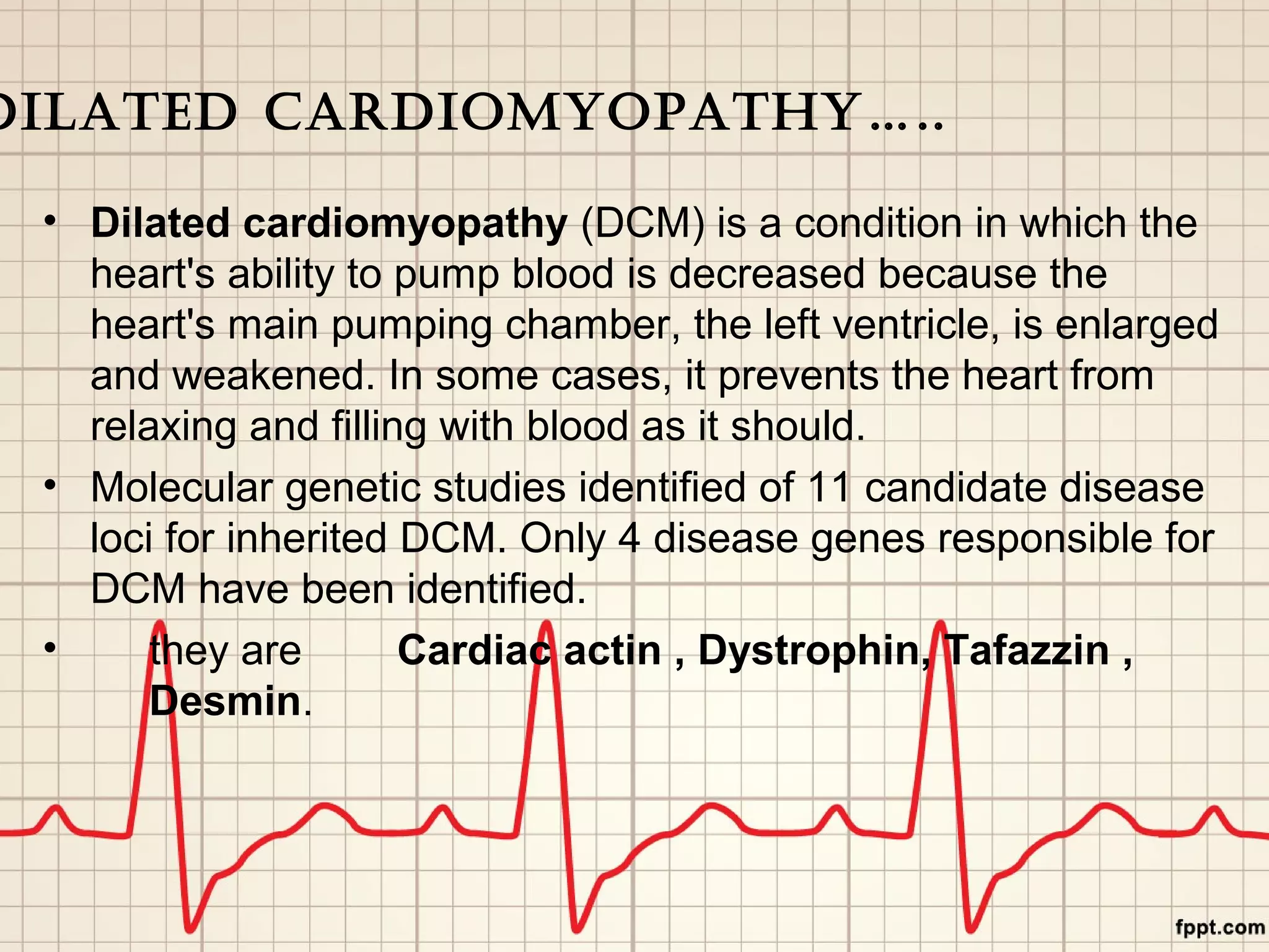 dilated cardiomyopathy | PPT