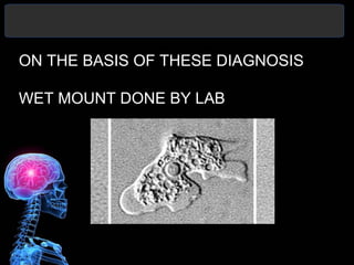 ON THE BASIS OF THESE DIAGNOSIS
WET MOUNT DONE BY LAB
 